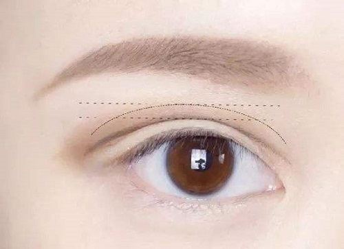 半切雙眼皮和全切雙眼皮的區別在於眼瞼的創口大小不同。半切雙眼皮和全切雙眼皮壹樣，都屬於做開刀手術做雙眼皮方法，但全切雙眼皮和半切雙眼皮也有很多不同